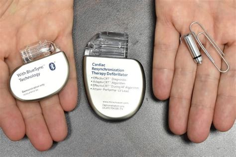 Different Types Of Pacemakers And Implantable Defibrillators Porn Sex