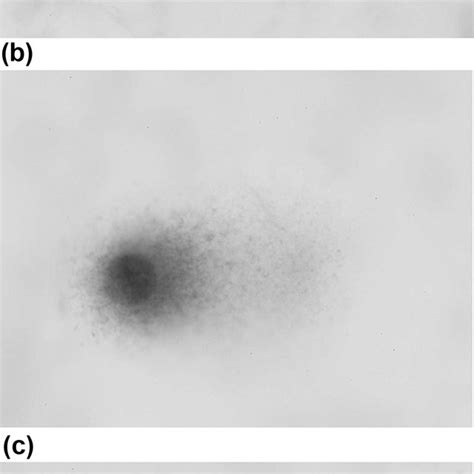 7 Cells Treated With The Single Cell Gel Electrophoresis Comet Assay