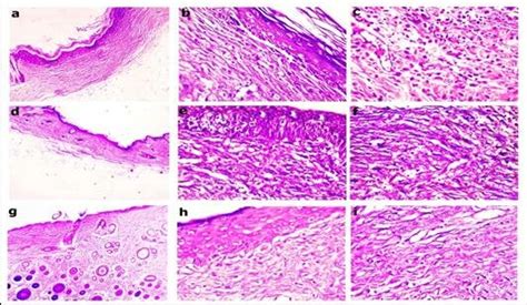 H E Stained Histological Sections Of A Wound At 14 Days From Diabetic