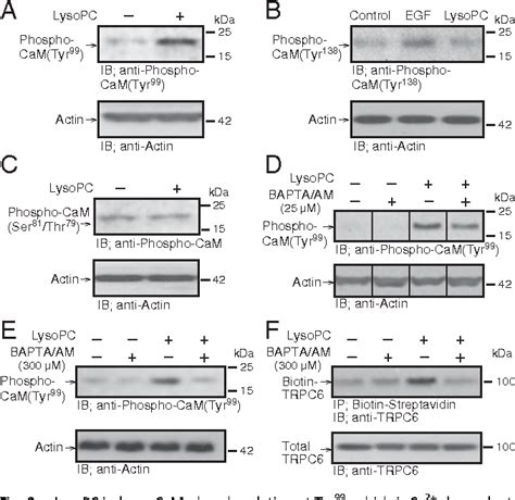 Figure 2 From Membrane Translocation Of TRPC6 Channels And Endothelial