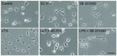 Morphological Changes Of Microglia Activated By LPS Representative