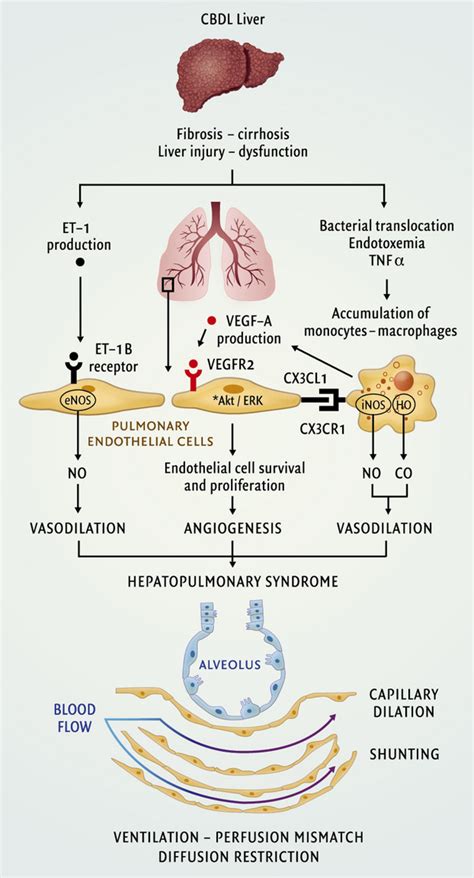 Hepatopulmonary Syndrome And Portopulmonary Hypertension Recent