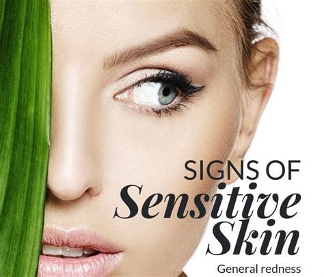 Sensitive Skin And Natural Care Rijal S Blog