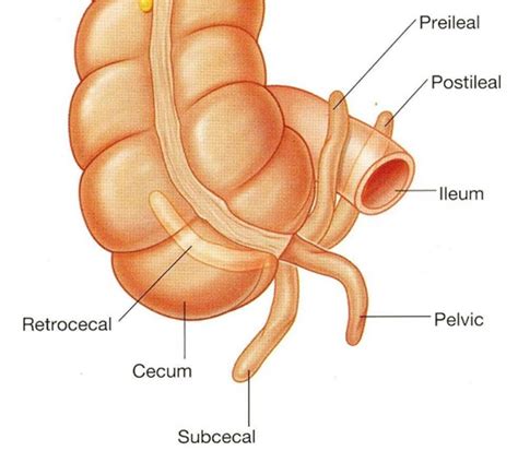 Figure 1 Various Positions Of The Vermiform Appendix 10 Anatomical