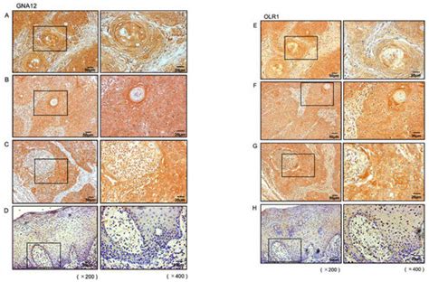 Ijms Free Full Text Impact Of Oncogenic Targets By Tumor