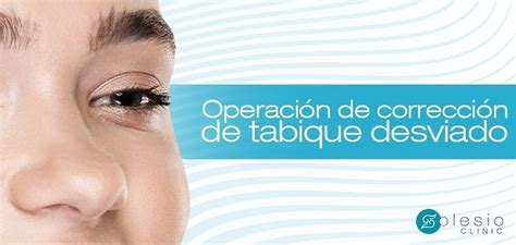 Operación de corrección de tabique nasal desviado en clínica Kyra