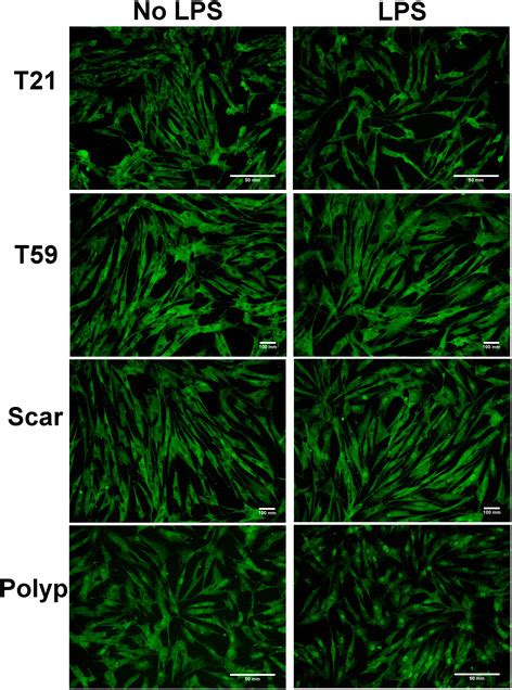 Lps Stimulated Upregulation Of Nf ĸb In Vff Scar And Polyp Vocal Fold