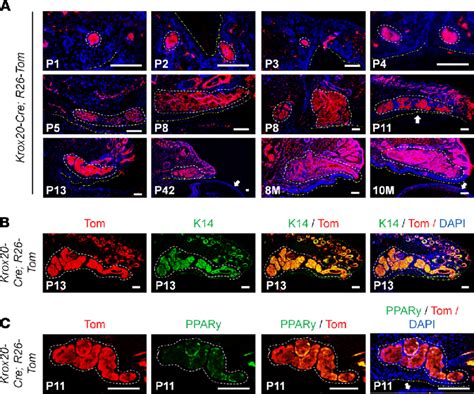 Krox Lineage Tracing In The Meibomian Gland A Lineage Tracing Of