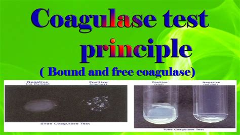 Coagulase Test Principle Bound And Free Coagulase Youtube