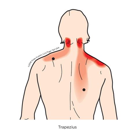 National Association Of Myofascial Trigger Point Therapists