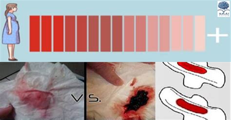 عالم عاجل وخاص للسيدات فقط لون دم الدورة الشهرية وقوامه وما يشير