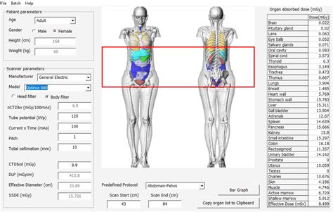 Estimation Of Organ Specific Cancer And Mortality Risks Associated With