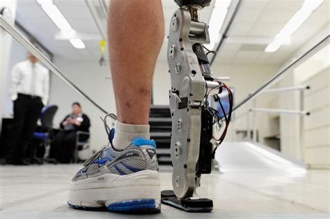 Empowering Mobility Exploring The Prosthetics And Orthotics