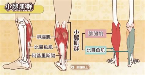 小腿痛不一定是肌肉拉傷、抽筋！圖解5大可能原因，8招助改善 健康遠見