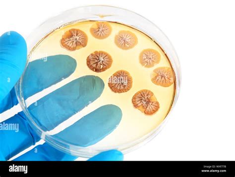 Hongos Microorganismos En Placa De Agar En Laboratorio Sobre Fondo