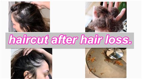 Hair Loss Haircut Telogen Effluvium Recovery Youtube