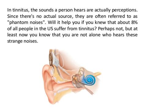 Constant Ringing In Ears Tinnitus Miracle Tm