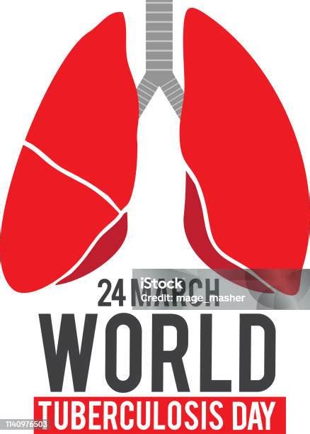 Mar24world Tuberkulosis 1 Ilustrasi Stok Unduh Gambar Sekarang