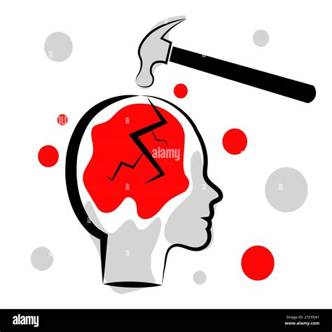 Headache Traumatic Brain Injury Stock Vector Image Art Alamy