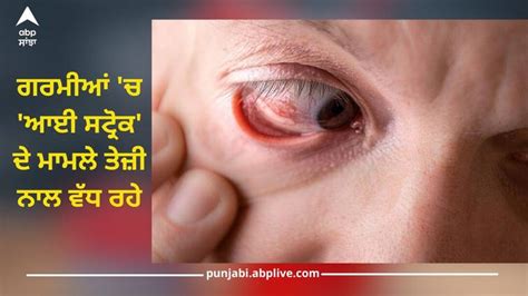 Eye Stroke ਗਰਮੀਆਂ ਚ ਆਈ ਸਟ੍ਰੋਕ ਦੇ ਮਾਮਲੇ ਤੇਜ਼ੀ ਨਾਲ ਵੱਧ ਰਹੇ ਰੋਕਥਾਮ ਲਈ