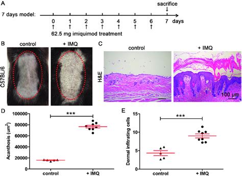 Establishment Of Imq Induced Psoriasis Model In Mice A Schematic