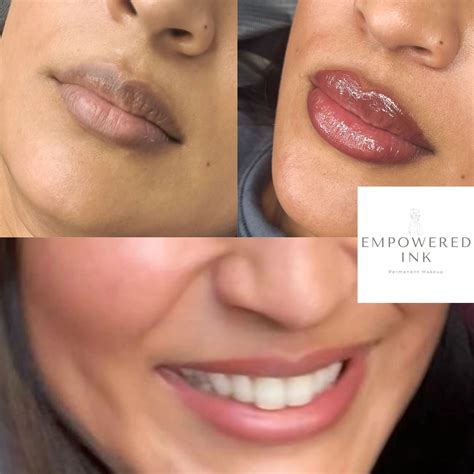 What Is Lip Neutralization