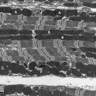 Representative Electron Micrograph Of Adult Murine Heart Depicting