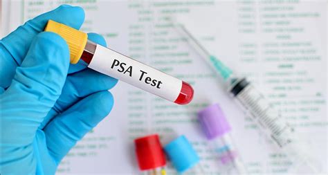 Import Ncia Do Exame Psa Na Preven O Do Cancro Da Pr Stata