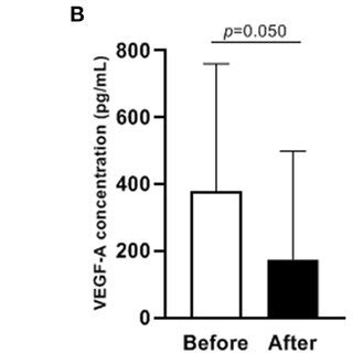 Levels Of Pdgf Bb Vegf A And Hif Before And After Ibuprofen