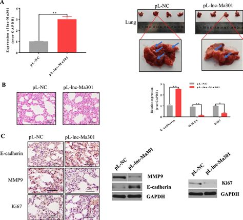 Lnc Ma Inhibits The Lung Metastasis Ability Of Hcc Cells In Vivo A