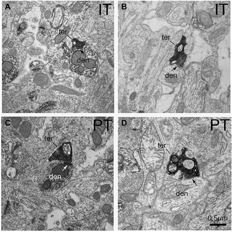 Em Micrographs Showing Ittype And Pt Type Axodendritic Synaptic