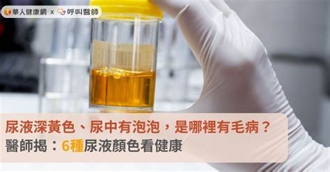 尿液深黃色、尿中有泡泡，是哪裡有毛病？醫師揭：6種尿液顏色看健康 蕃新聞