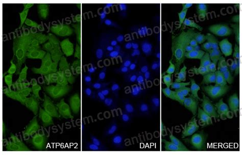 Buy Anti ATP6AP2 Polyclonal Antibody