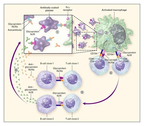 Immune Thrombocytopenic Purpura New England Journal Of Medicine