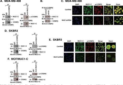 Figure From Muc C Oncoprotein Activates Erkc Ebp Signaling And