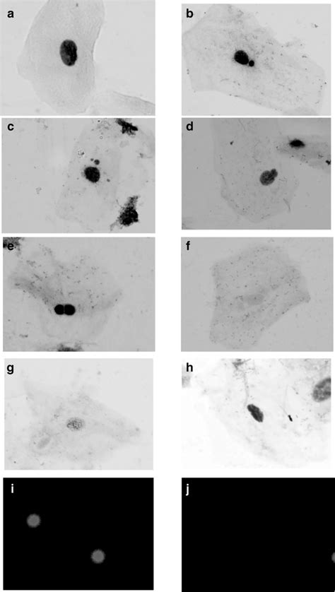 Photomicrographs ×1000 Of Representative Cell Types In Exfoliated Download Scientific Diagram