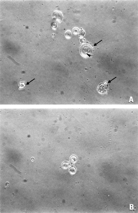 Phase Contrast Micrographs Showing Examples Of Two Short Term Breast