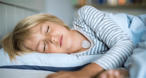 Snoring In A Child Causes Consequences And Treatment Clebre A