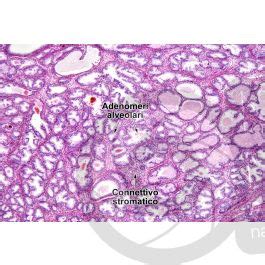 Uomo Prostata Sezione Trasversale X Uomo Mammiferi Apparato