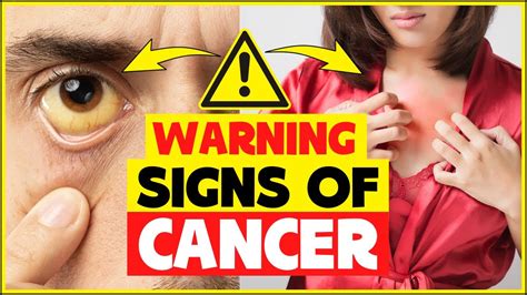 Warning Signs Of Cancer You Should Not Ignore Symptoms Cancer And