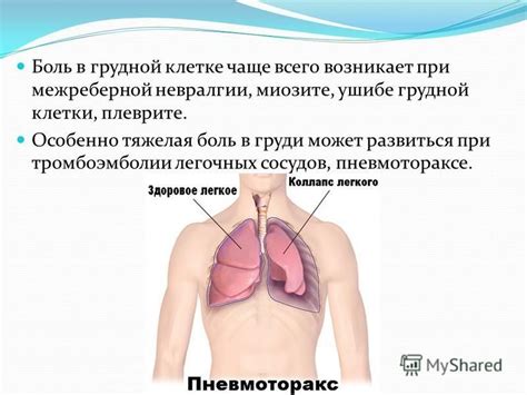Презентация на тему: "Заболевания органов дыхания Терапия". Скачать ...