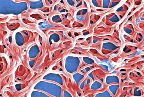 Borrelia burgdorferi - DocCheck