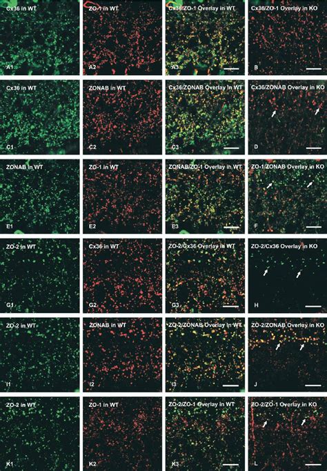 Immunofluorescence Labeling Of Cx Zo Zo And Zonab In The Ipl Of