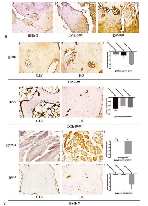 A Immunohistochemical Analysis Of Bmp Tgf Beta And Decorin In