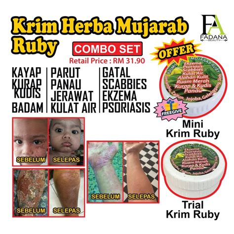 All 2 Cream Masalah Kulit 3 Gatal Eczema Fungus Ubat Kudis Krim