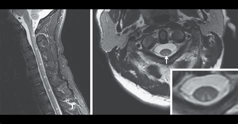 Nejm On Twitter A Year Old Man Presented With A Week History Of