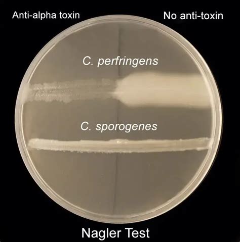 Nagler Reaction Lecithinase Test Biology Notes Online