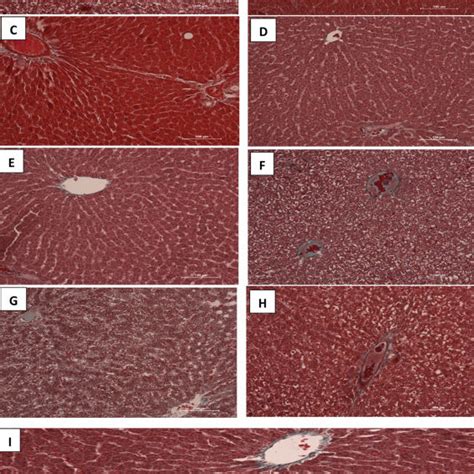 A I Photomicrograph Of The Liver Sections Stained With Masson Download Scientific Diagram