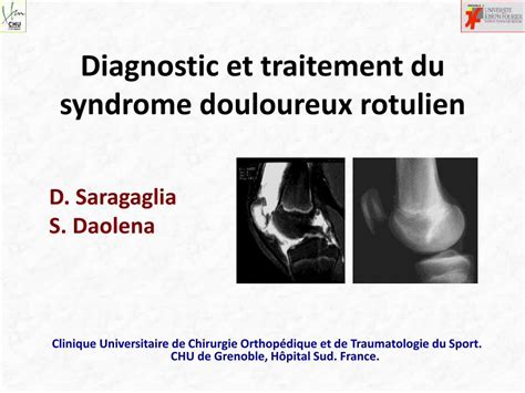 PDF Diagnostic Et Traitement Du Syndrome Douloureux Rotulien