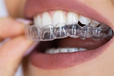 Can Mouth Guards Help With Sleep Apnea